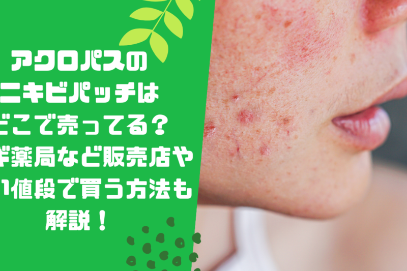 アクロパスのニキビパッチはどこで売ってる？スギ薬局など販売店や安い値段で買う方法も解説！